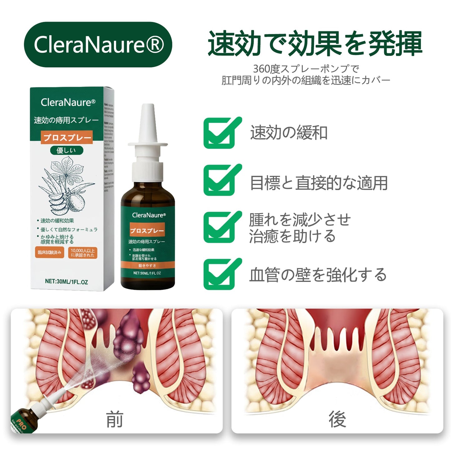 💎限定キャンペーン | CleraNaure® 速効性痔疾用PROスプレー