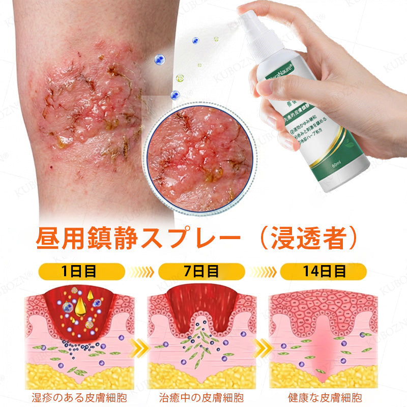 💎CleraNaure® エクゼマ デイ＆ナイトリペアシステム —— 100％ステロイドフリーのデュオケア 激しいかゆみ・赤み・荒れた肌にダブルでアプローチ