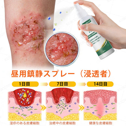 💎CleraNaure® エクゼマ デイ＆ナイトリペアシステム —— 100％ステロイドフリーのデュオケア 激しいかゆみ・赤み・荒れた肌にダブルでアプローチ
