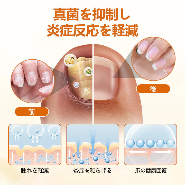 🫧CleraNaure® FungiBee Advanced ネイルリペアスプレー