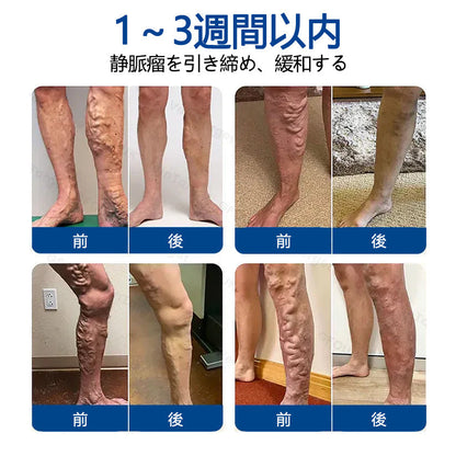 🥇Healrize® ヴェインターゲット マイクロニードルパッチ✨