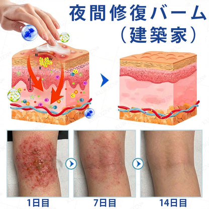 💎CleraNaure® エクゼマ デイ＆ナイトリペアシステム —— 100％ステロイドフリーのデュオケア 激しいかゆみ・赤み・荒れた肌にダブルでアプローチ