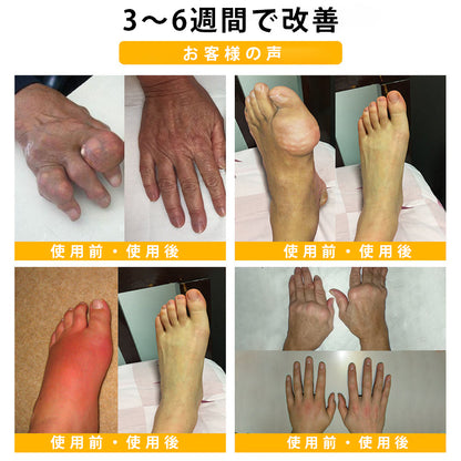 ❄️CleraNaure® ボツリヌストキシン＆蜂毒配合 鎮痛・骨癒合クリーム
