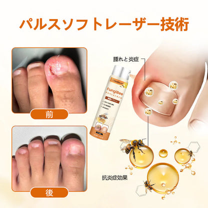 🫧CleraNaure® FungiBee Advanced ネイルリペアスプレー
