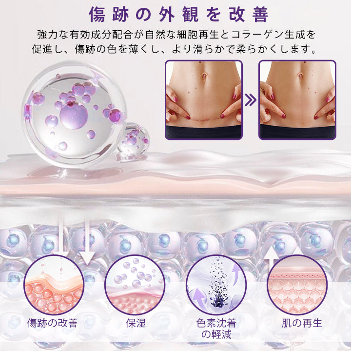 CleraNaure® ReGenScar ステムセル・スカーゲル