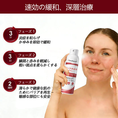 🥇CleraNaure® ビーフタロウスプレー — かゆみ・皮膚の剥がれを抑える乾癬用スキンケアスプレー