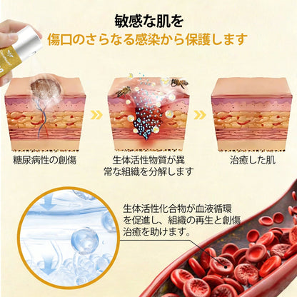 🔥CleraNaure® グルコシールド 蜂毒創傷スプレー