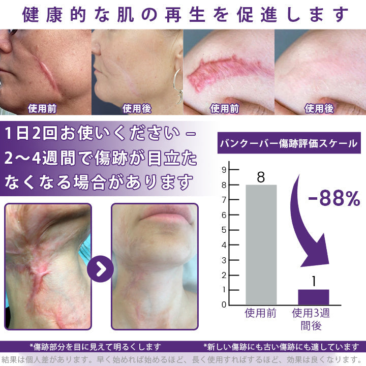 CleraNaure® ReGenScar ステムセル・スカーゲル