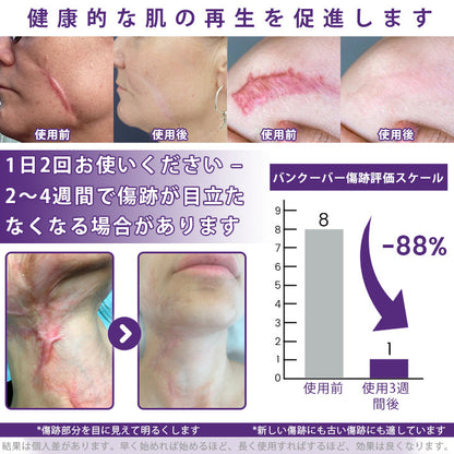 CleraNaure® ReGenScar ステムセル・スカーゲル