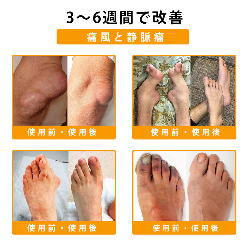 ❄️CleraNaure® ボツリヌストキシン＆蜂毒配合 鎮痛・骨癒合クリーム