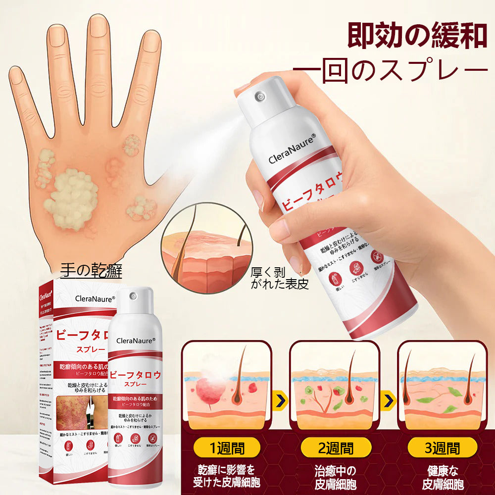 🥇CleraNaure® ビーフタロウスプレー — かゆみ・皮膚の剥がれを抑える乾癬用スキンケアスプレー
