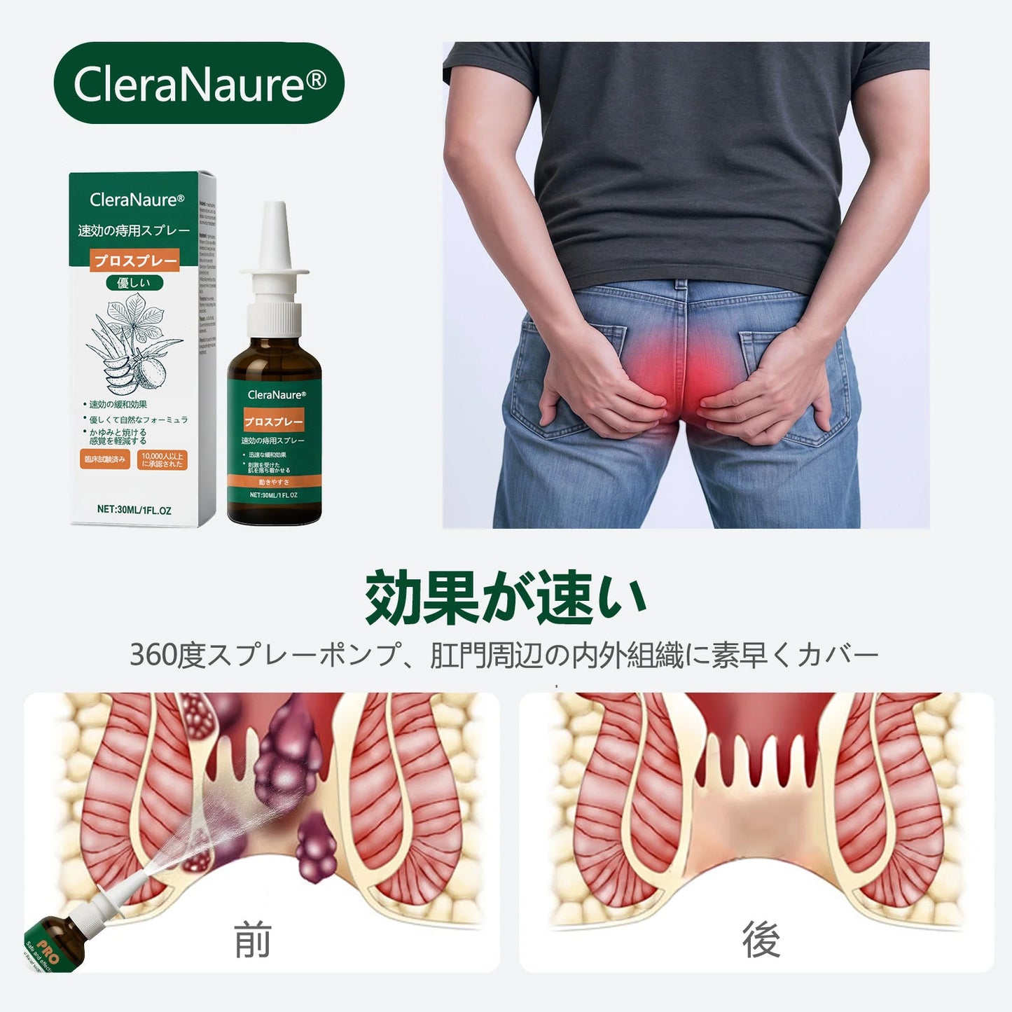💎限定キャンペーン | CleraNaure® 速効性痔疾用PROスプレー