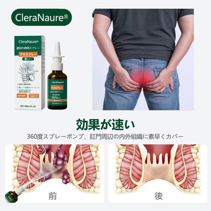 💎限定キャンペーン | CleraNaure® 速効性痔疾用PROスプレー