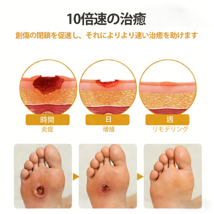 🔥CleraNaure® グルコシールド 蜂毒創傷スプレー