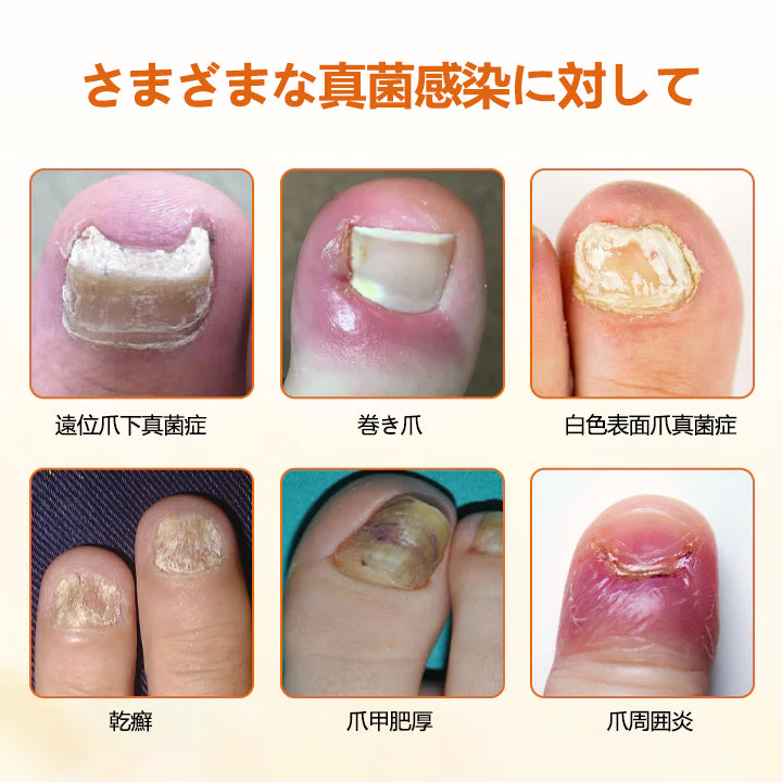 🫧CleraNaure® FungiBee Advanced ネイルリペアスプレー