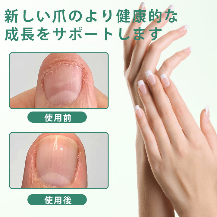 🥇CleraNaure® ネイルディトックス 浸透セラムペン