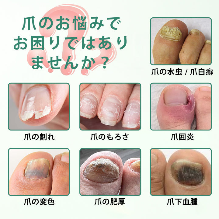 🥇CleraNaure® ネイルディトックス 浸透セラムペン