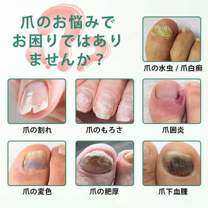 🥇CleraNaure® ネイルディトックス 浸透セラムペン